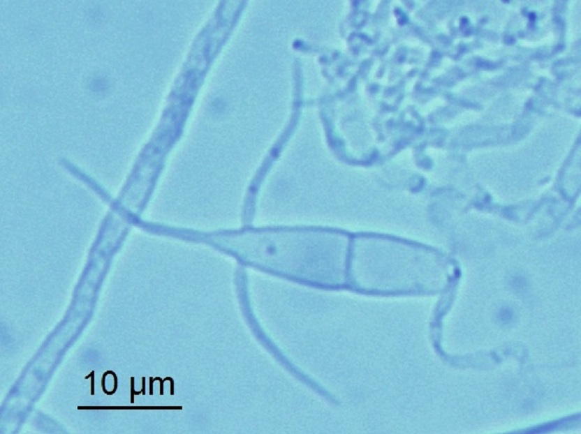 Представитель Класса Classiculomycetes